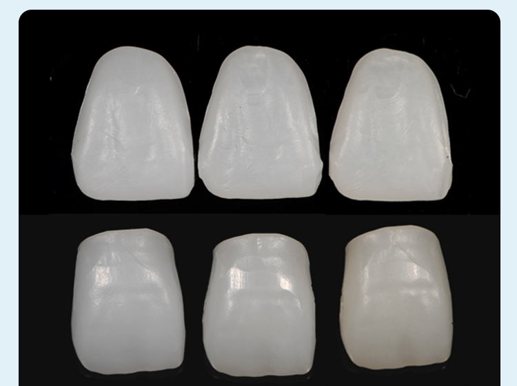 Denture base turns yellow, how to clean?