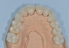 71mm ST+ White Zirconia Blocks