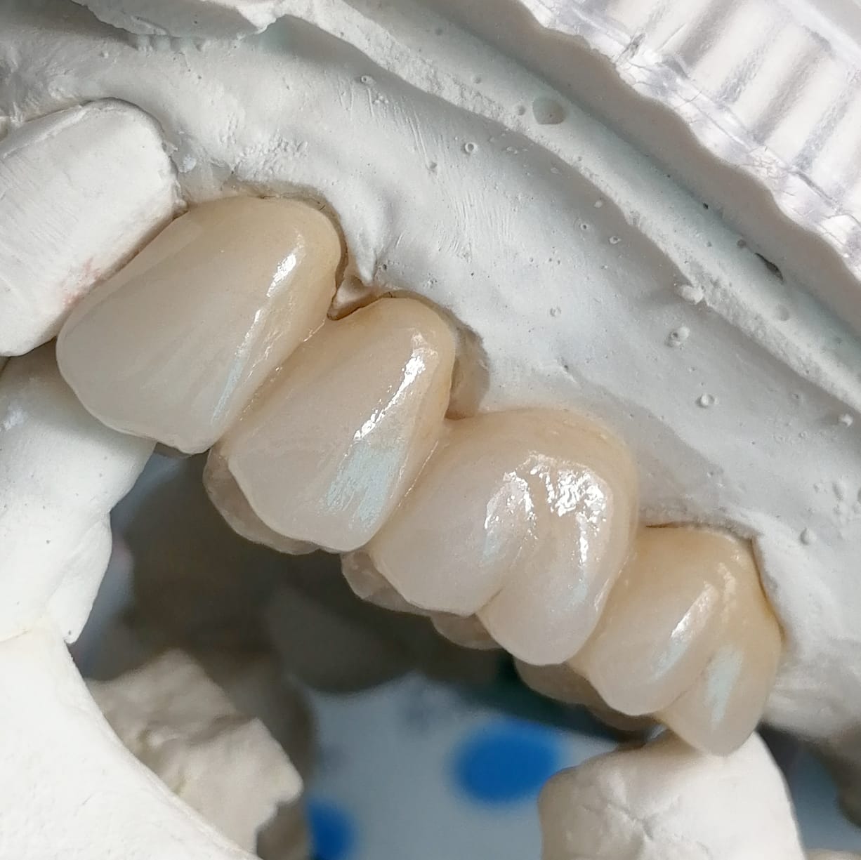71mm ST+ White Zirconia Blocks
