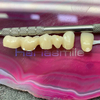 98mm ST+Multilayer Zirconia Blocks